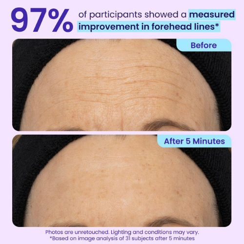 PureSkin™ Instant Lift Eye Gel